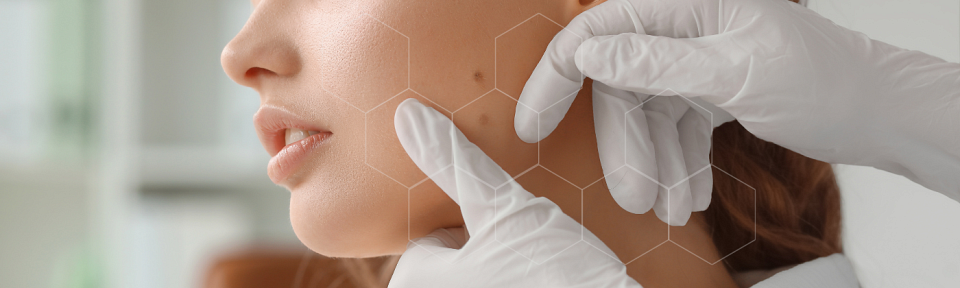 Integrative Dermatology: A Comprehensive Approach to Skin Health